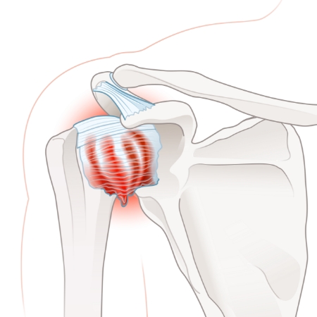 Seva-Orthopedic-Physical-Therapy-Princeton-NJ