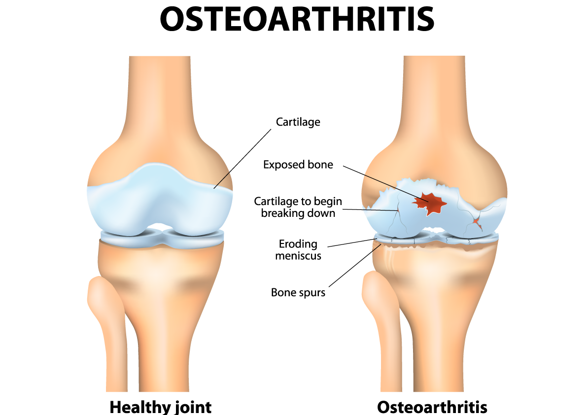 Seva-Orthopedic-Physical-Therapy-Princeton-NJ