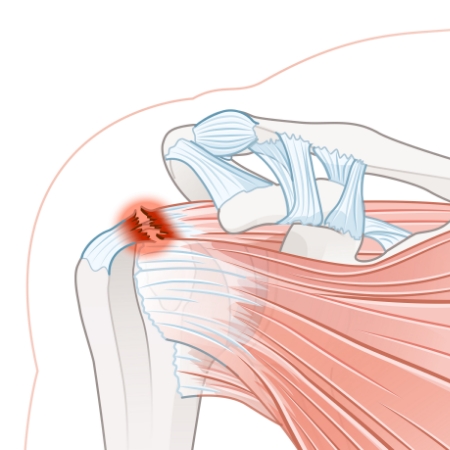 Seva-Orthopedic-Physical-Therapy-Princeton-NJ