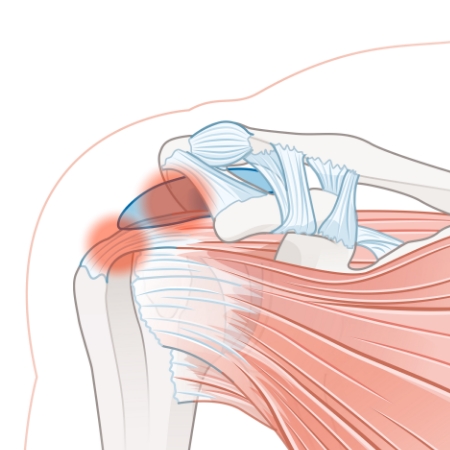 Seva-Orthopedic-Physical-Therapy-Princeton-NJ