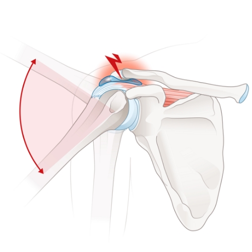 Seva-Orthopedic-Physical-Therapy-Princeton-NJ