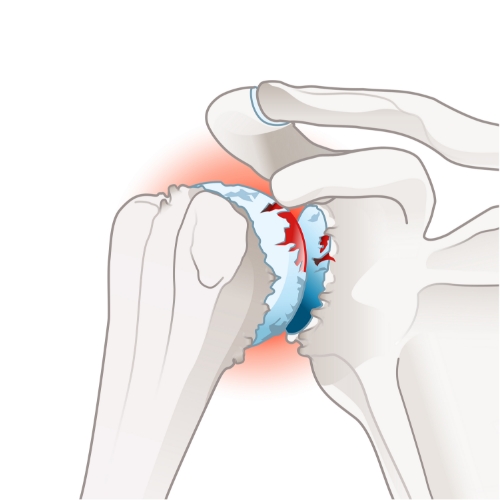 Seva-Orthopedic-Physical-Therapy-Princeton-NJ